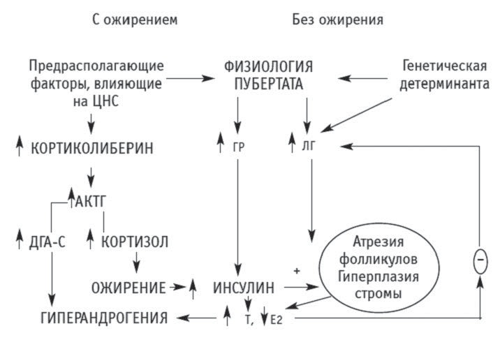 Лишний Вес При Поликистозе Яичников